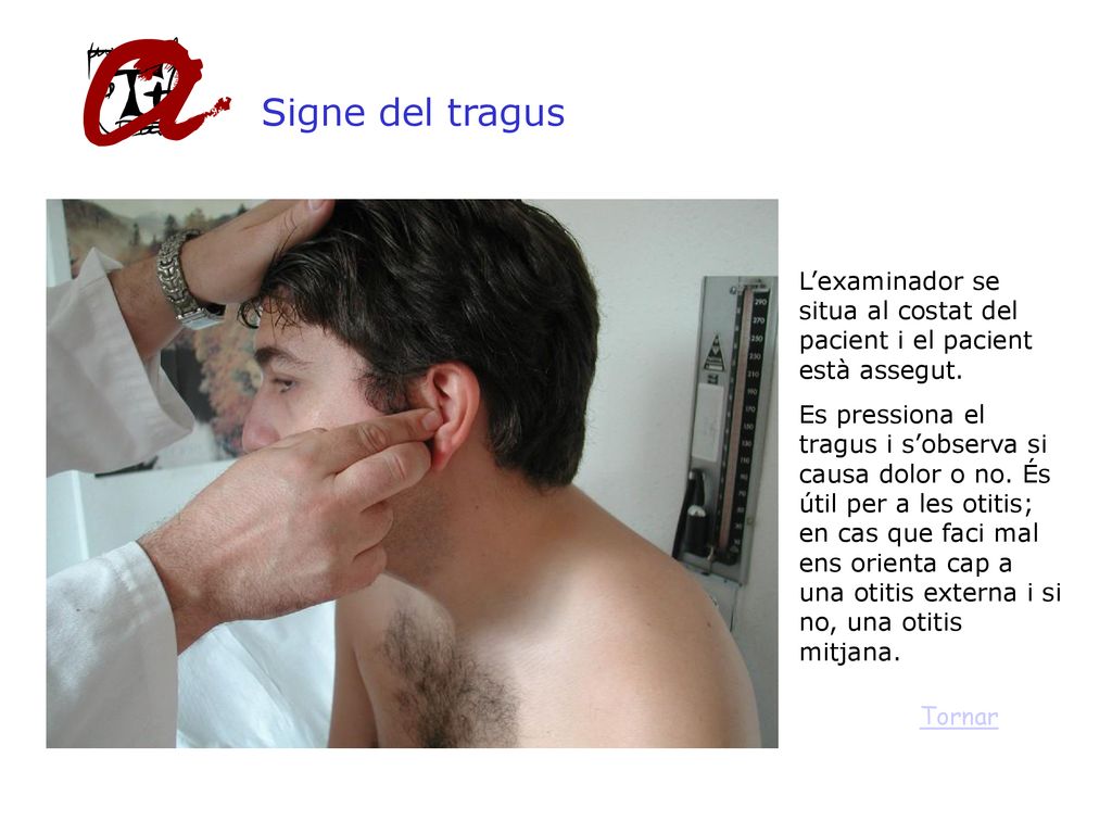 Signe del tragus L’examinador se situa al costat del pacient i el pacient està assegut.