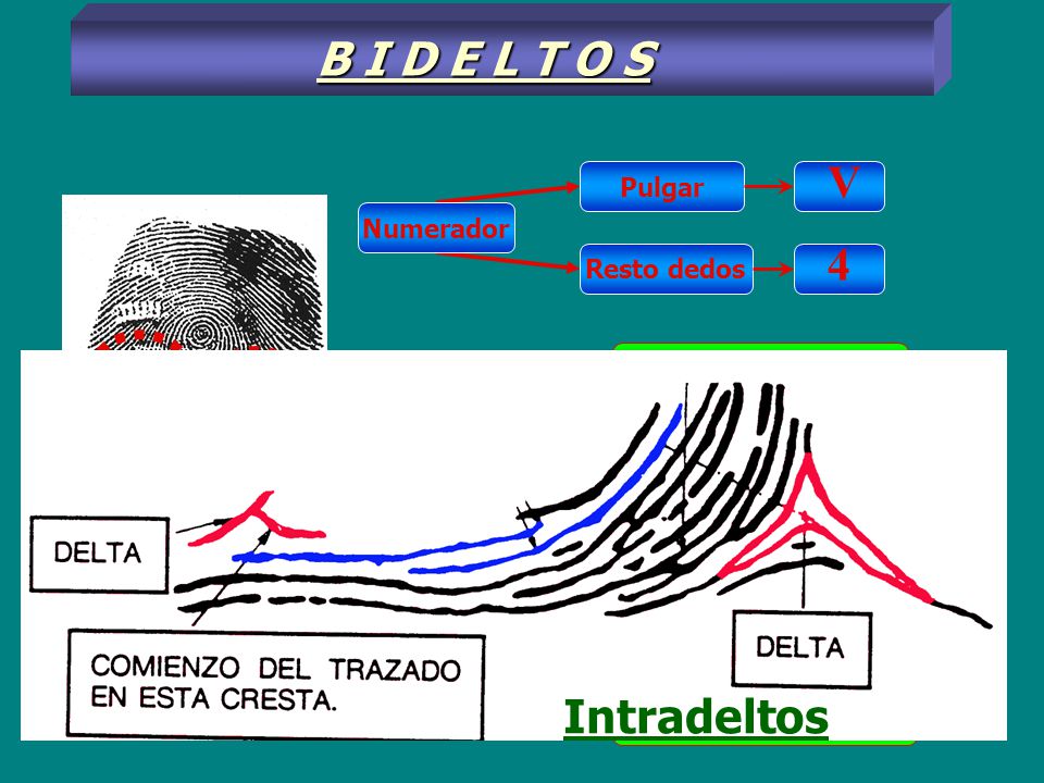 B I D E L T O S V 4 Intradeltos Intradelto - i- Extradelto - e -