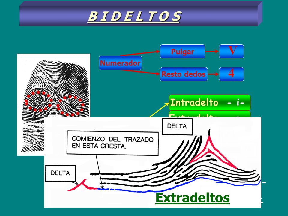 B I D E L T O S V 4 Extradeltos Intradelto - i- Extradelto - e -