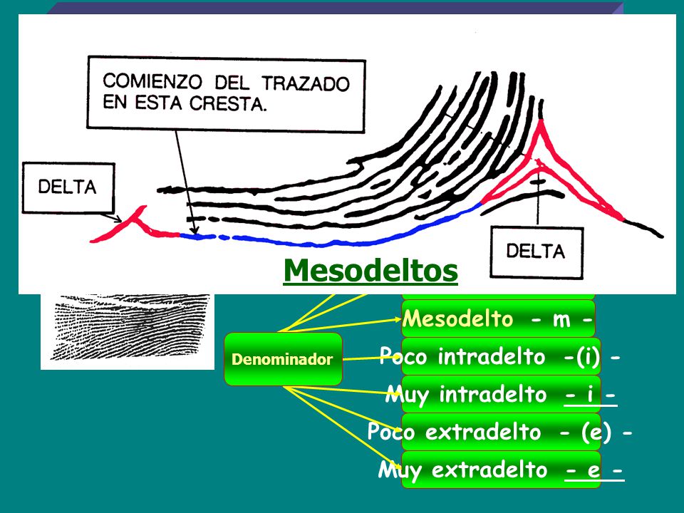 B I D E L T O S V 4 Mesodeltos Intradelto - i- Extradelto - e -