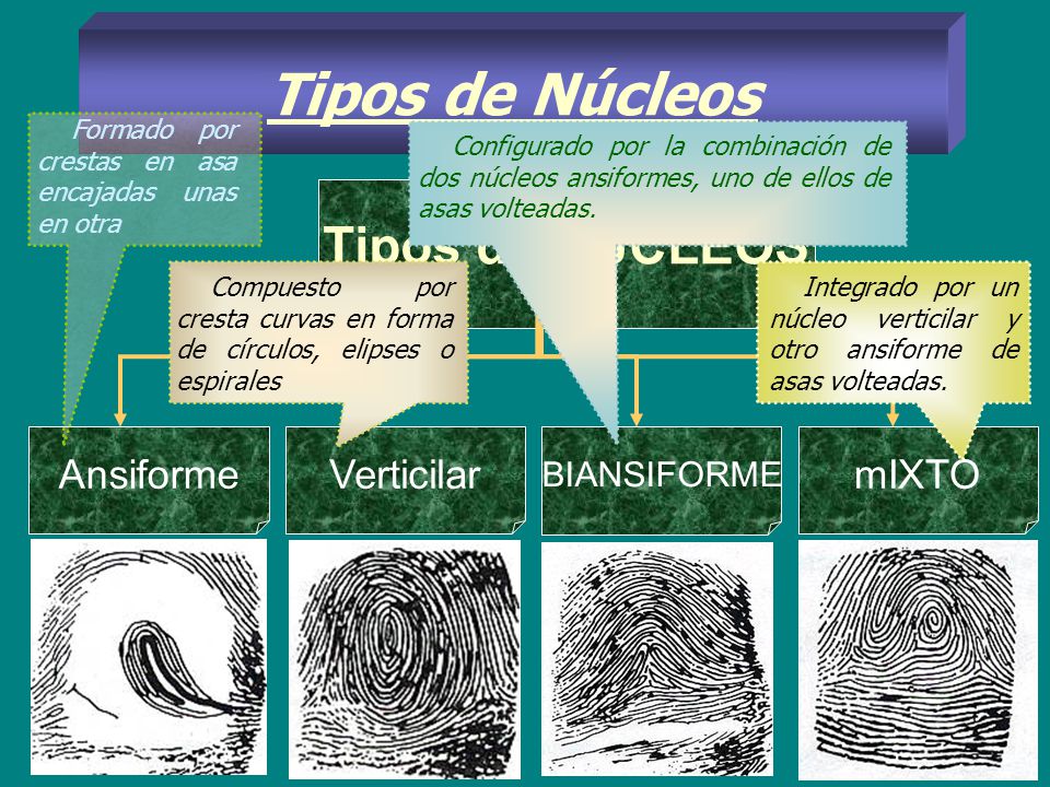 Tipos de Núcleos Tipos de NUCLEOS Ansiforme Verticilar mIXTO