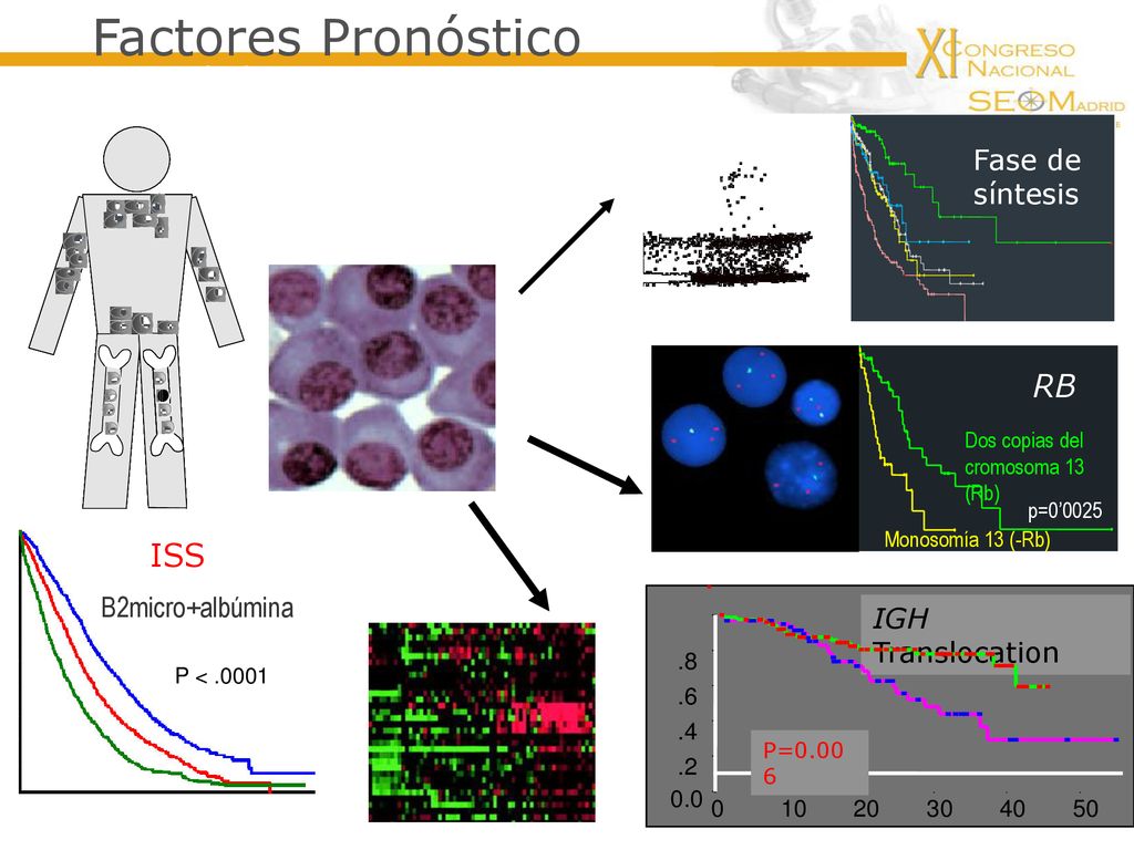 Factores Pronóstico Edad ECOG RB ISS Fase de síntesis B2micro+albúmina