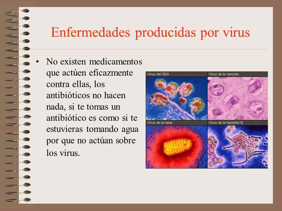 Enfermedades producidas por virus