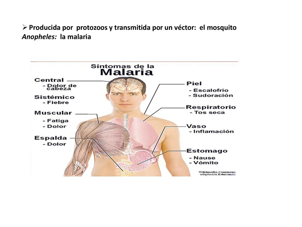 Producida por protozoos y transmitida por un véctor: el mosquito Anopheles: la malaria