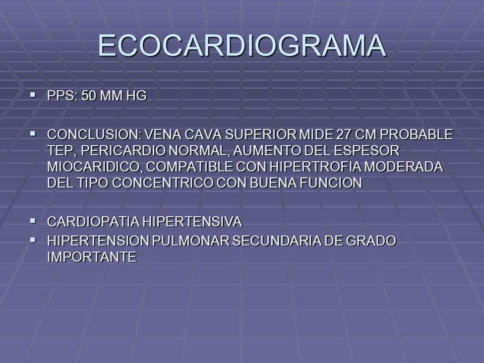 ECOCARDIOGRAMA PPS: 50 MM HG