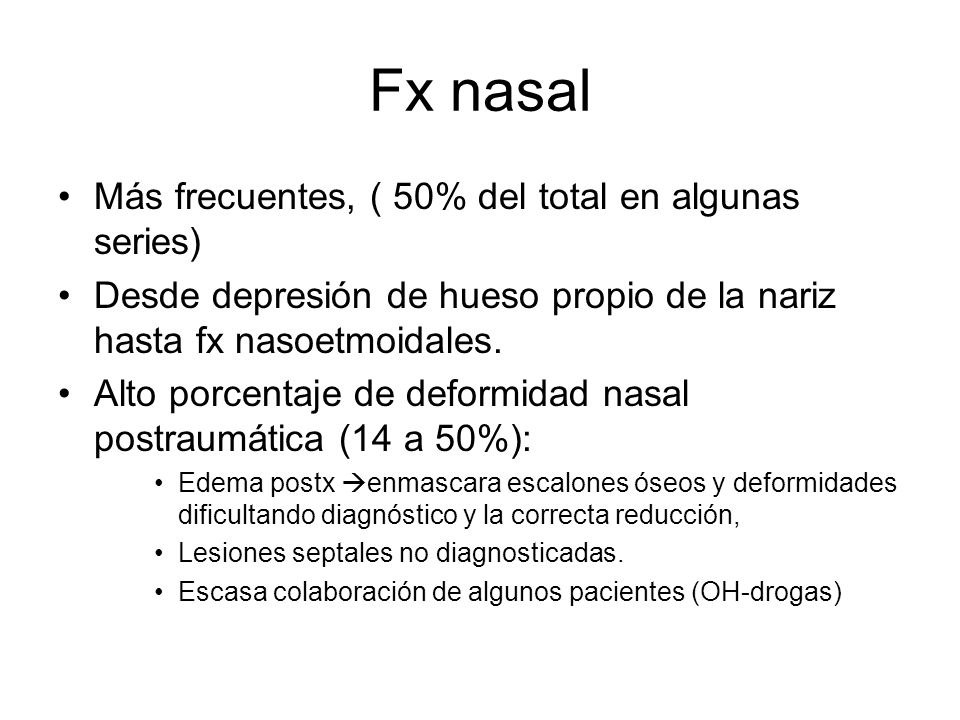 Fx nasal Más frecuentes, ( 50% del total en algunas series)