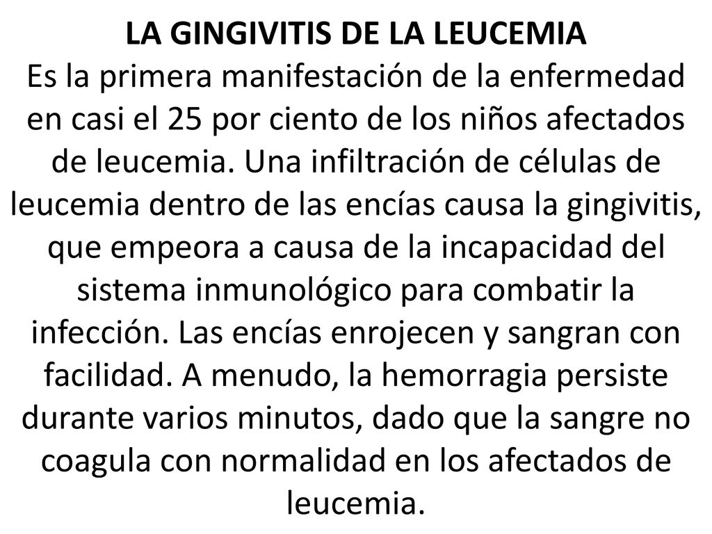 LA GINGIVITIS DE LA LEUCEMIA Es la primera manifestación de la enfermedad en casi el 25 por ciento de los niños afectados de leucemia.