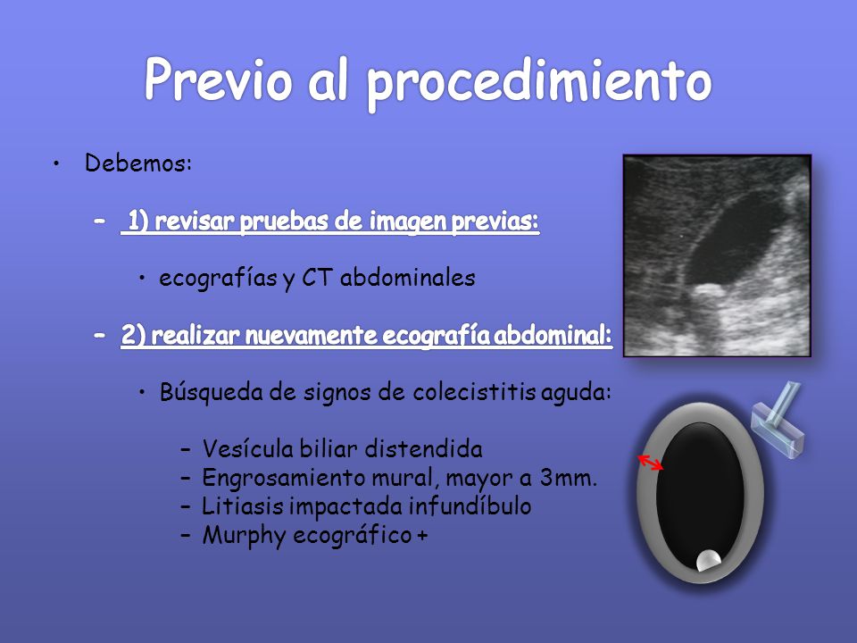 Previo al procedimiento