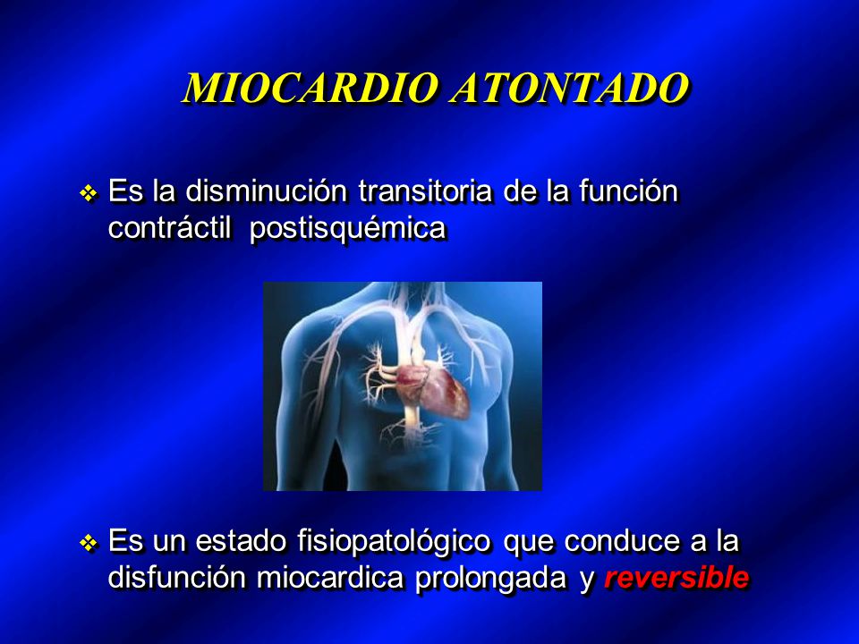 MIOCARDIO ATONTADO Es la disminución transitoria de la función contráctil postisquémica.