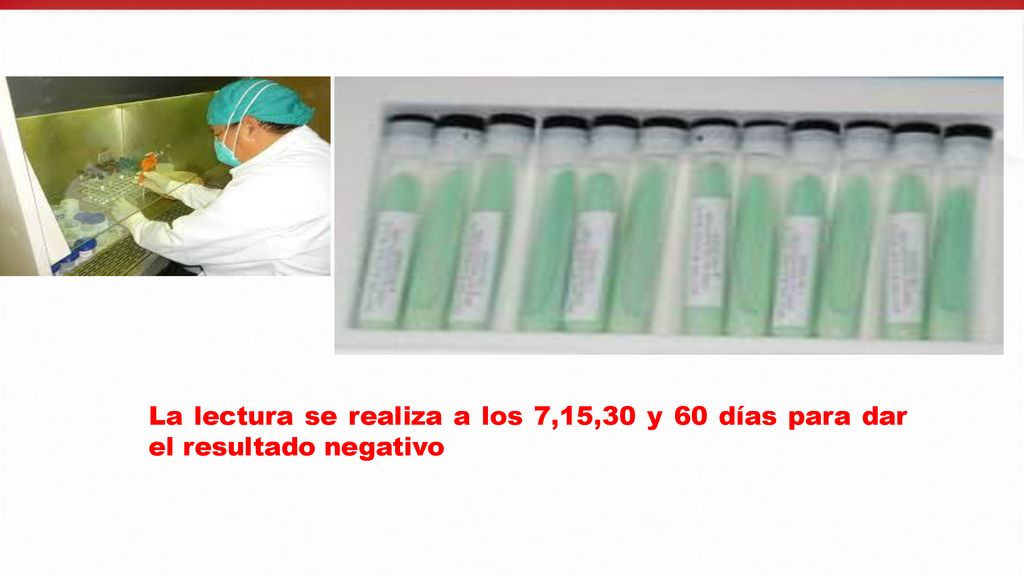La lectura se realiza a los 7,15,30 y 60 días para dar el resultado negativo