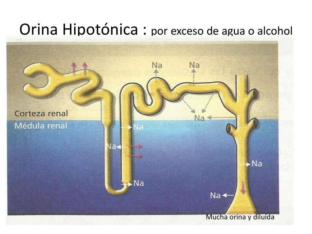 Orina Hipotónica : por exceso de agua o alcohol