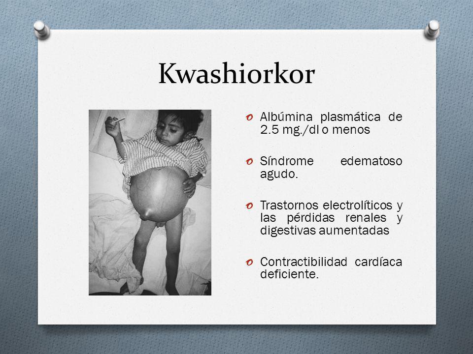 Kwashiorkor Albúmina plasmática de 2.5 mg./dl o menos