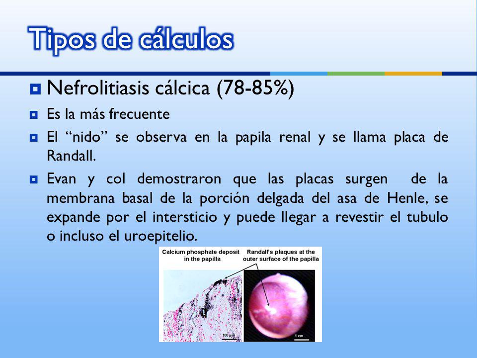 Tipos de cálculos Nefrolitiasis cálcica (78-85%) Es la más frecuente