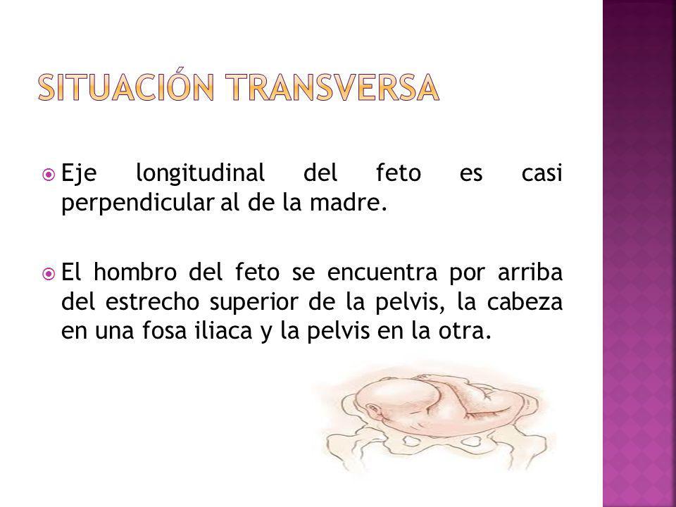 Situación transversa Eje longitudinal del feto es casi perpendicular al de la madre.