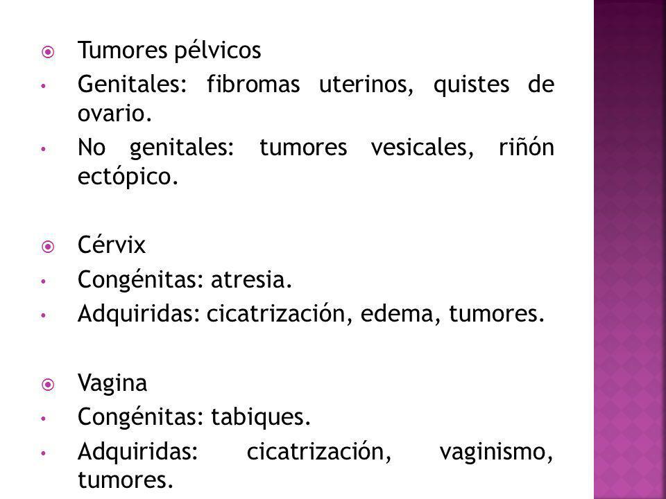 Tumores pélvicos Genitales: fibromas uterinos, quistes de ovario. No genitales: tumores vesicales, riñón ectópico.