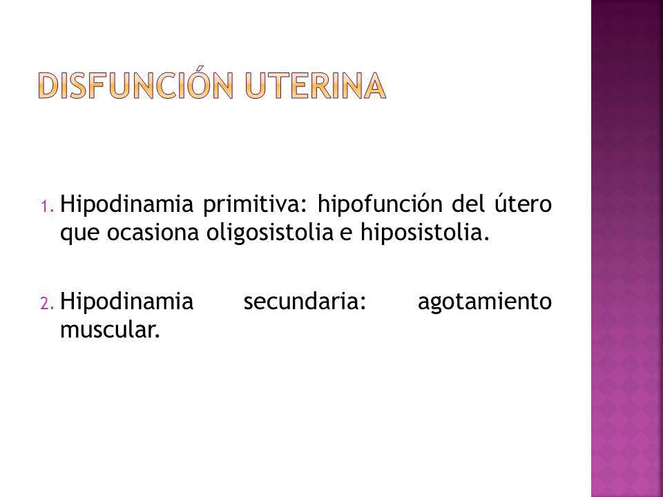 Disfunción uterina Hipodinamia primitiva: hipofunción del útero que ocasiona oligosistolia e hiposistolia.