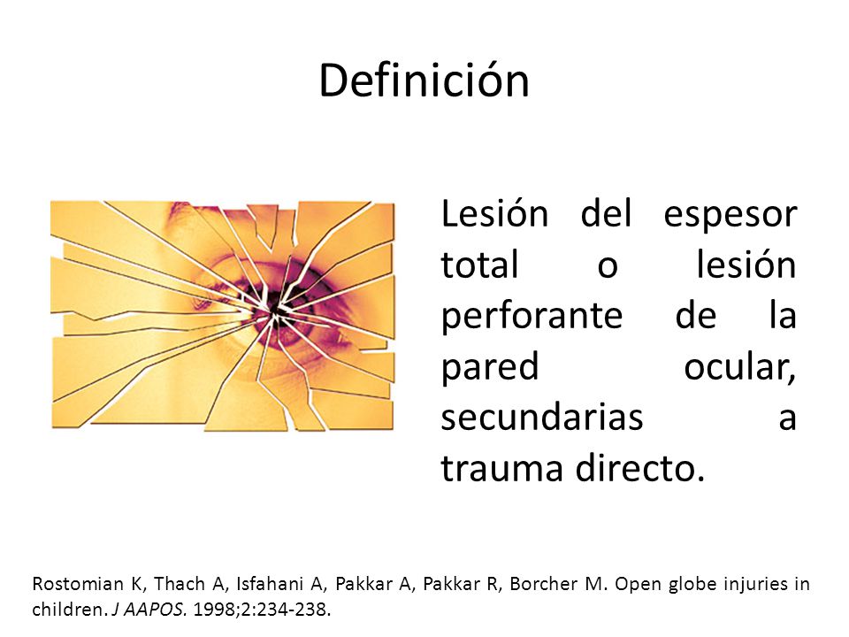 Definición Lesión del espesor total o lesión perforante de la pared ocular, secundarias a trauma directo.