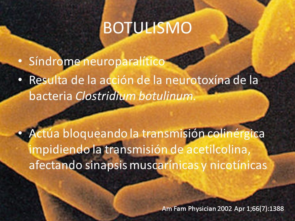 Ботулизм сальмонеллез. Информация о Clostridium botulinum.
