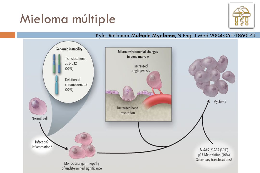 Mieloma múltiple Kyle, Rajkumar Multiple Myeloma, N Engl J Med 2004;351: