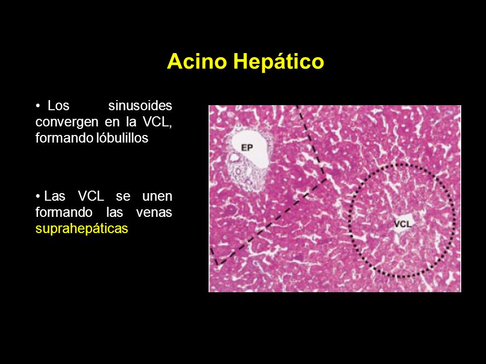 Acino Hepático Los sinusoides convergen en la VCL, formando lóbulillos