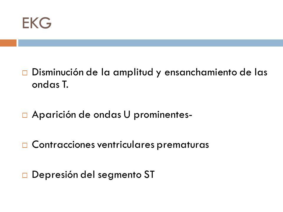 EKG Disminución de la amplitud y ensanchamiento de las ondas T.