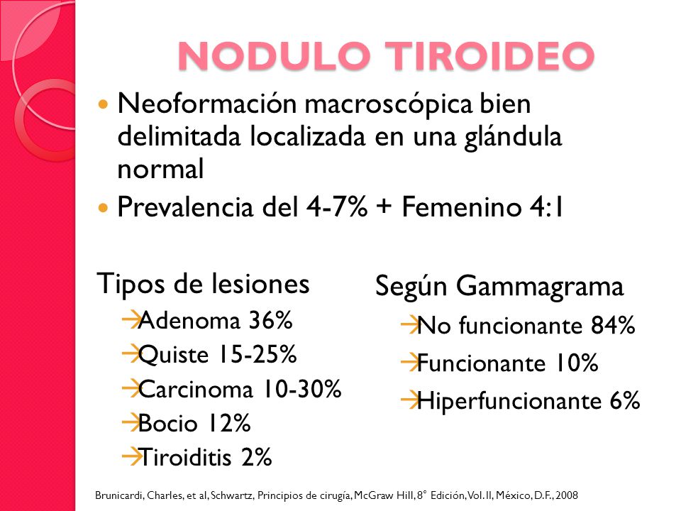 NODULO TIROIDEO Neoformación macroscópica bien delimitada localizada en una glándula normal. Prevalencia del 4-7% + Femenino 4:1.