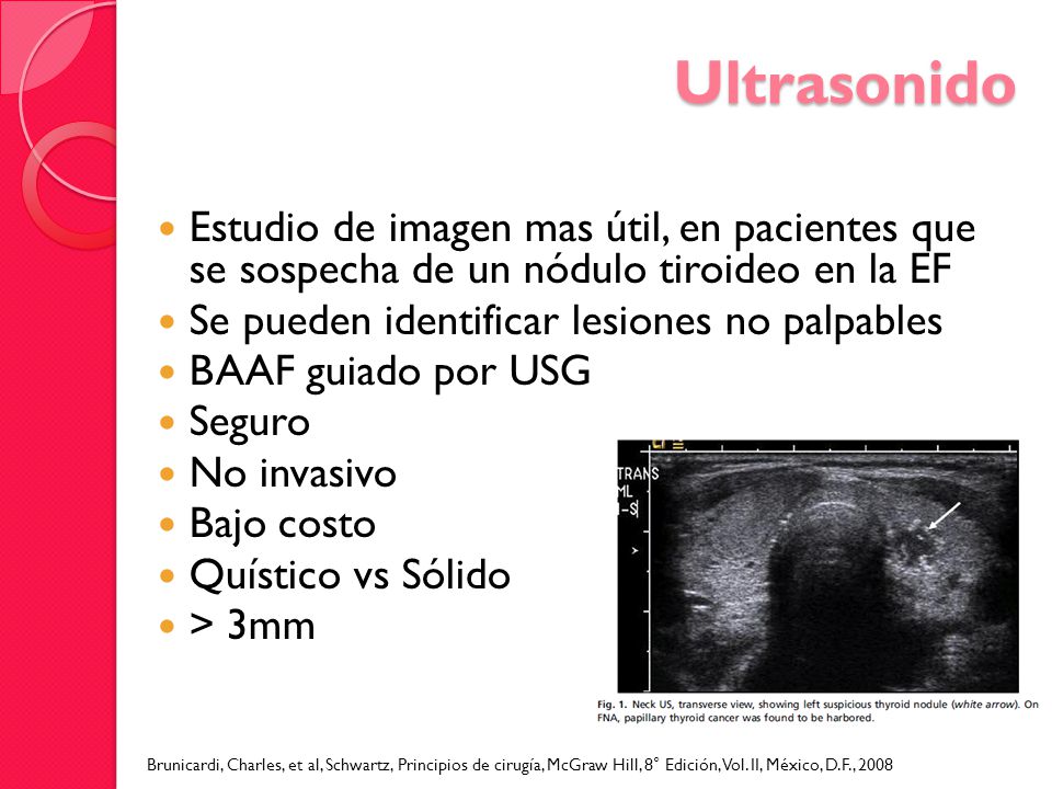 Ultrasonido Estudio de imagen mas útil, en pacientes que se sospecha de un nódulo tiroideo en la EF.