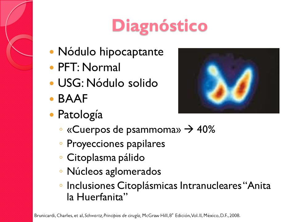 Diagnóstico Nódulo hipocaptante PFT: Normal USG: Nódulo solido BAAF