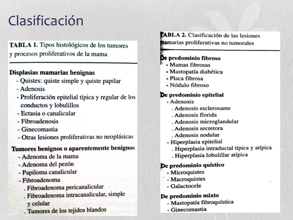 Tipos de quistes mamarios