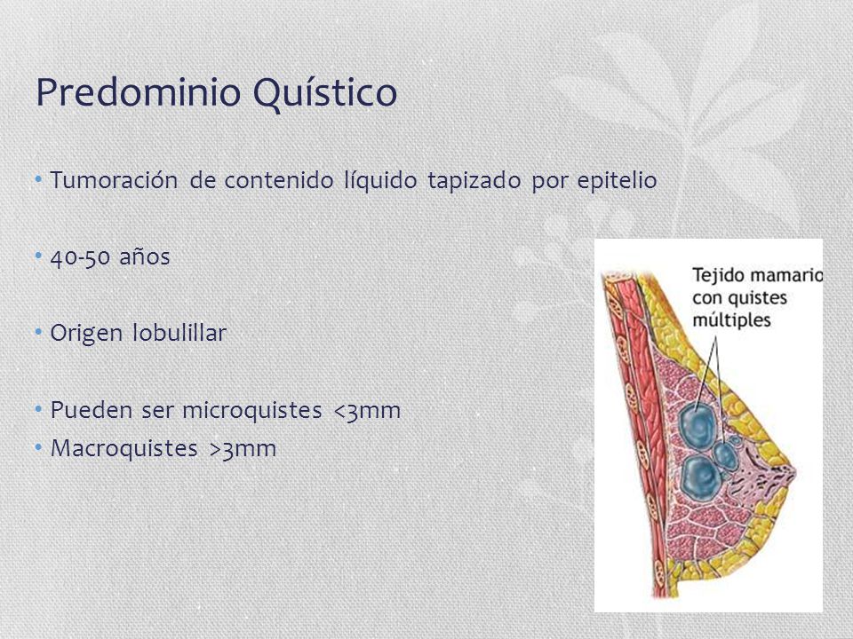Predominio Quístico Tumoración de contenido líquido tapizado por epitelio años. Origen lobulillar.