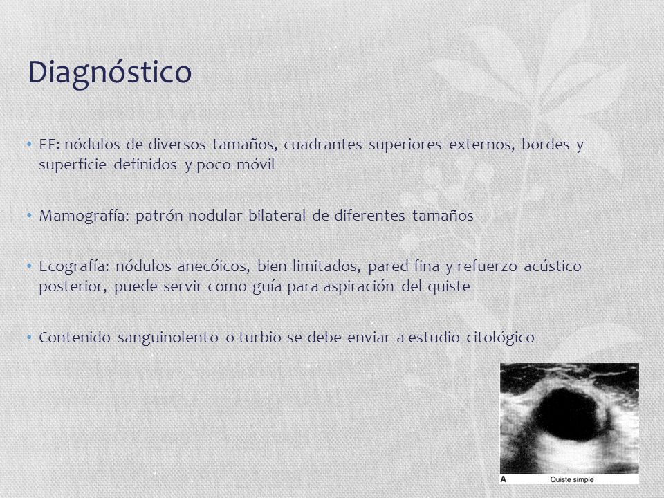 Diagnóstico EF: nódulos de diversos tamaños, cuadrantes superiores externos, bordes y superficie definidos y poco móvil.