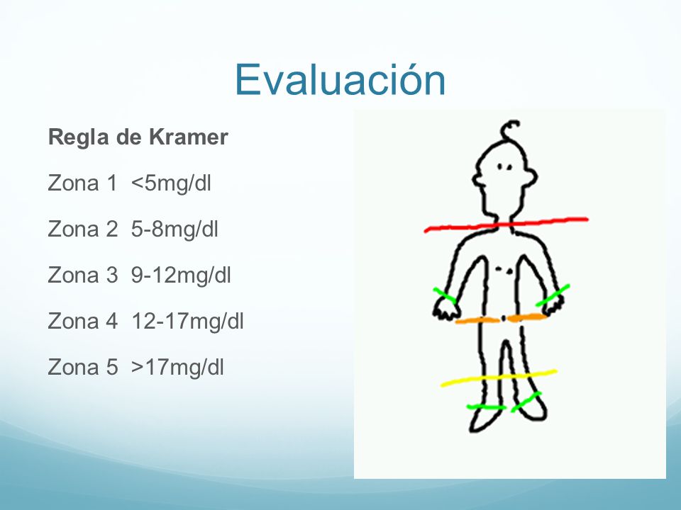 Evaluación Regla de Kramer Zona 1 <5mg/dl Zona 2 5-8mg/dl Zona mg/dl Zona mg/dl Zona 5 >17mg/dl