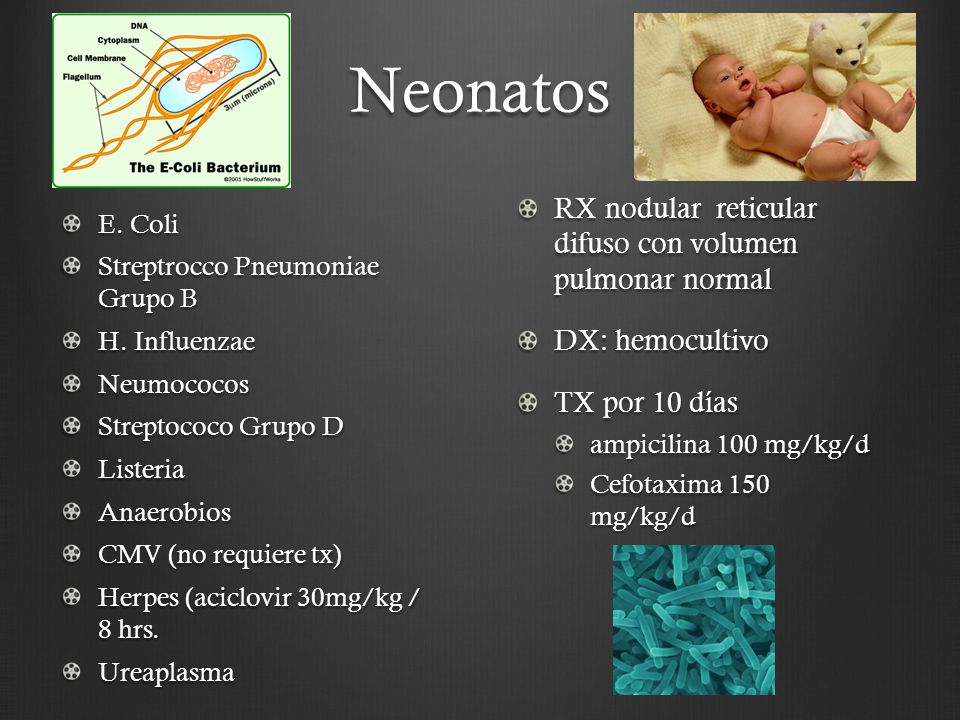 Neonatos RX nodular reticular difuso con volumen pulmonar normal
