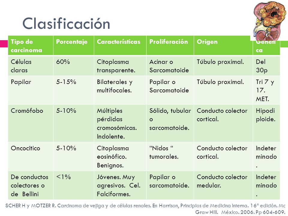 Clasificación Tipo de carcinoma Porcentaje Características