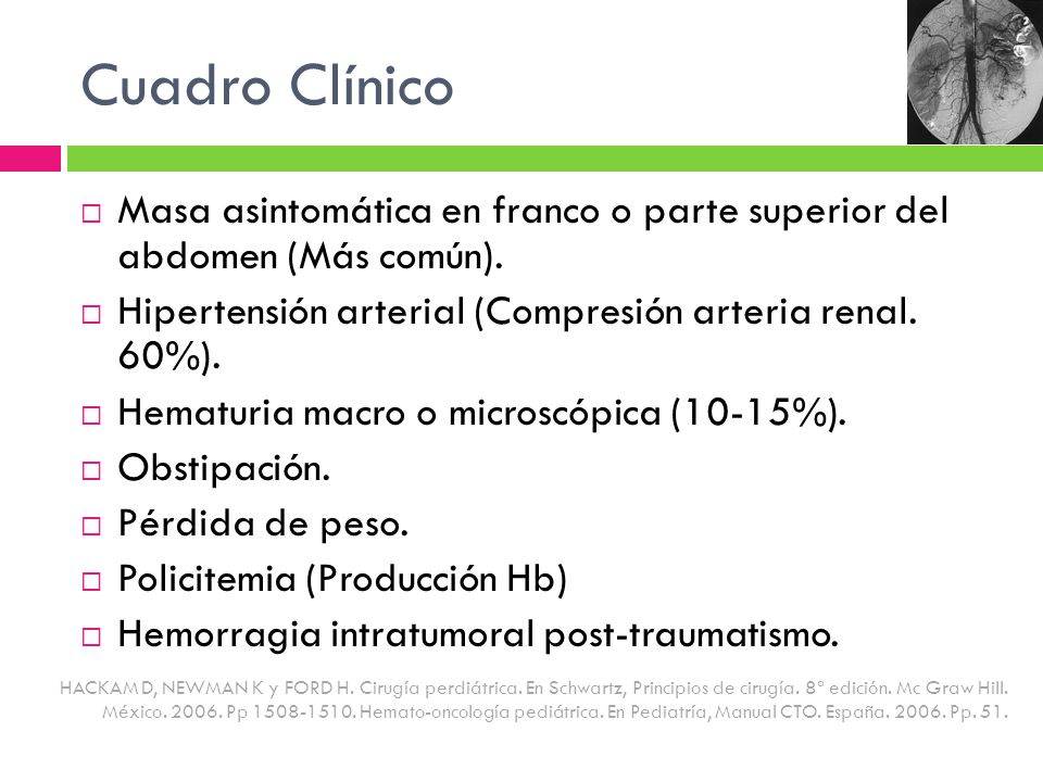 Cuadro Clínico Masa asintomática en franco o parte superior del abdomen (Más común). Hipertensión arterial (Compresión arteria renal. 60%).
