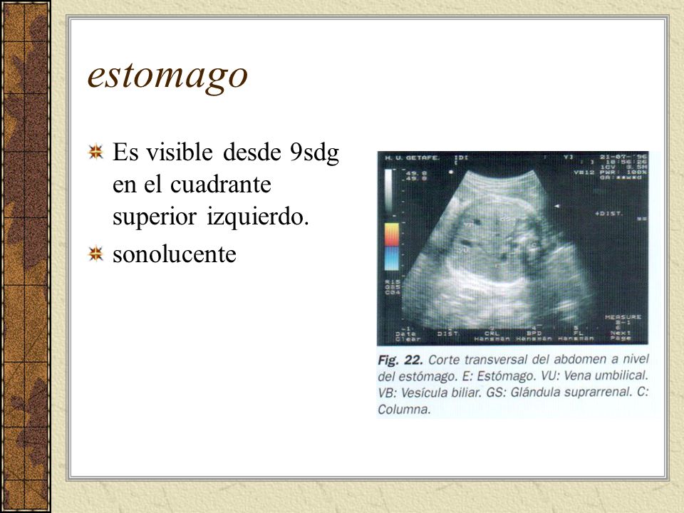 estomago Es visible desde 9sdg en el cuadrante superior izquierdo.