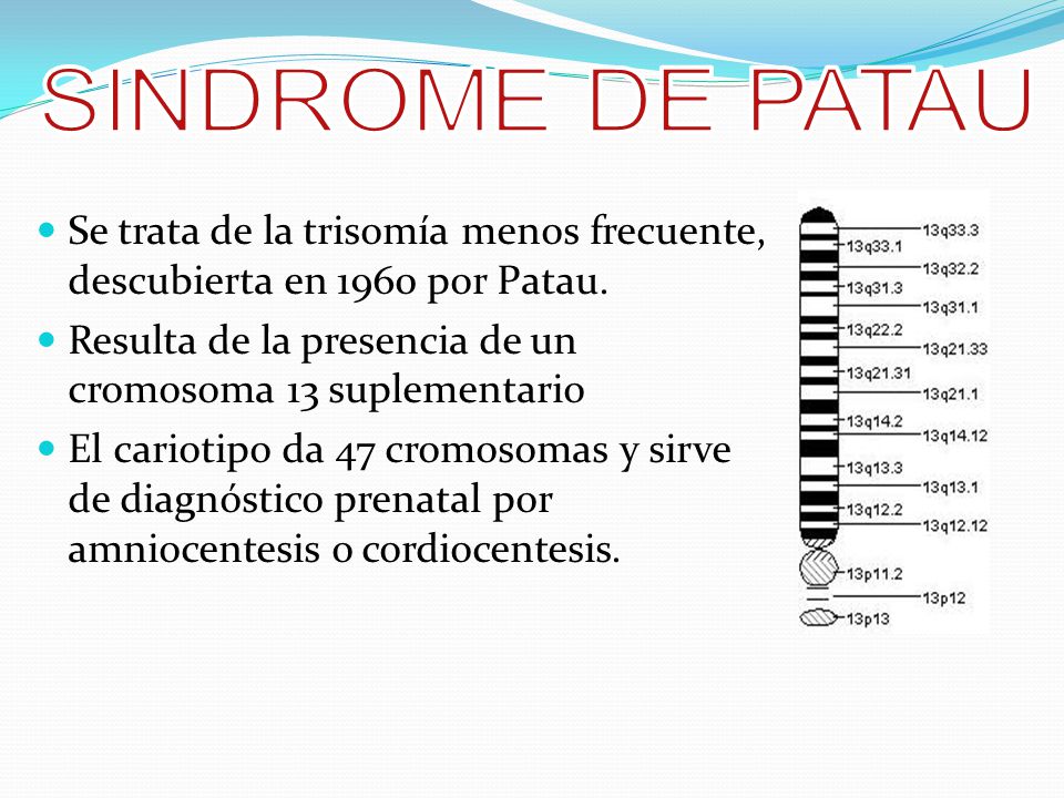 SINDROME DE PATAU Se trata de la trisomía menos frecuente, descubierta en 1960 por Patau. Resulta de la presencia de un cromosoma 13 suplementario.