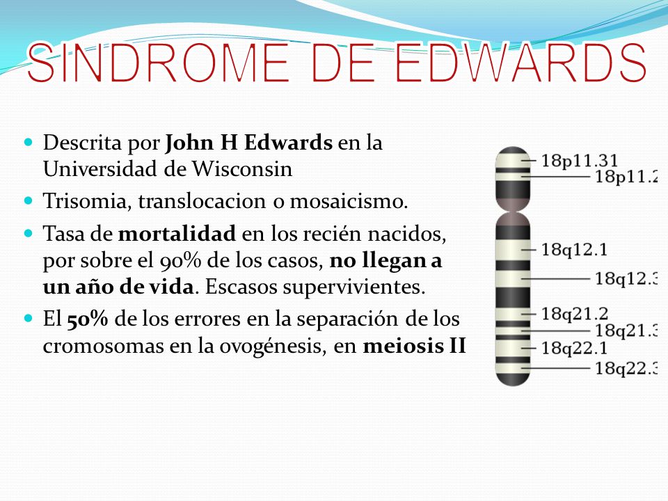 SINDROME DE EDWARDS Descrita por John H Edwards en la Universidad de Wisconsin. Trisomia, translocacion o mosaicismo.