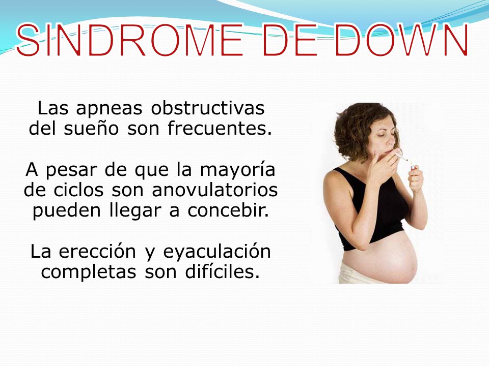 SINDROME DE DOWN Las apneas obstructivas del sueño son frecuentes.