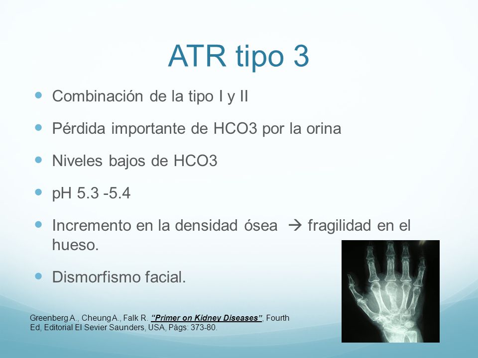 ATR tipo 3 Combinación de la tipo I y II