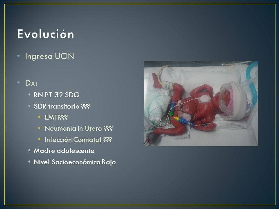 Evolución Ingresa UCIN Dx: RN PT 32 SDG SDR transitorio EMH