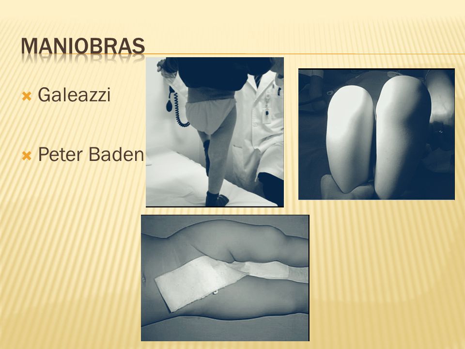 Maniobras Galeazzi Peter Baden