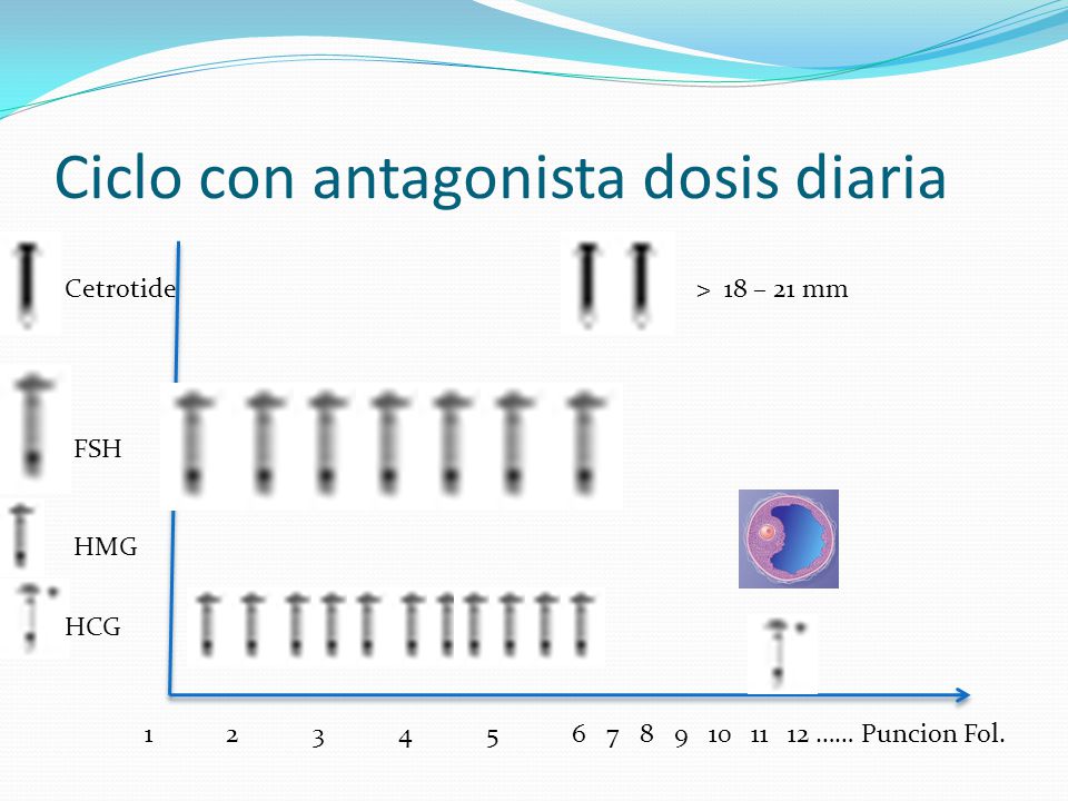 Ciclo con antagonista dosis diaria