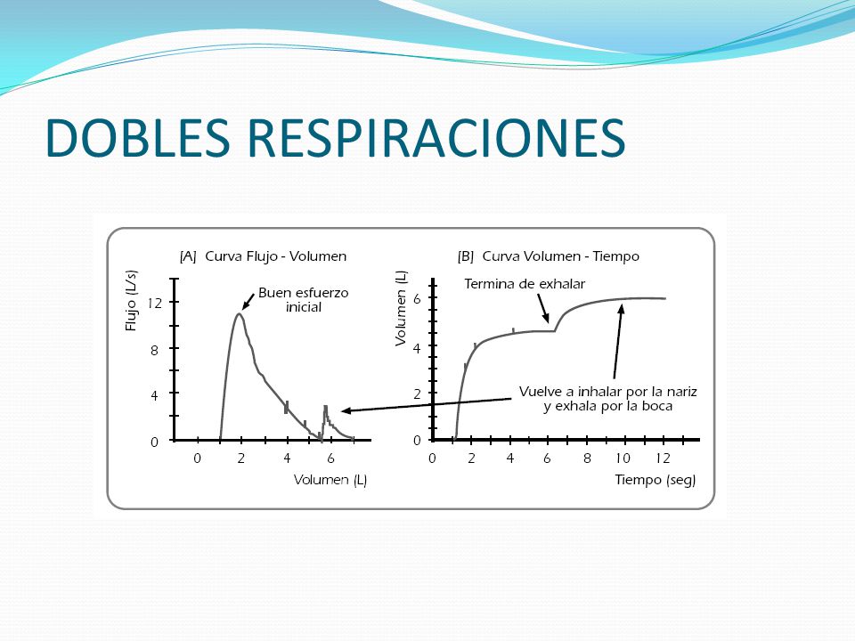 DOBLES RESPIRACIONES Estos artefactos pueden ser relativamente frecuentes. Durante la exhalación, el individuo vuelve a inhalar.