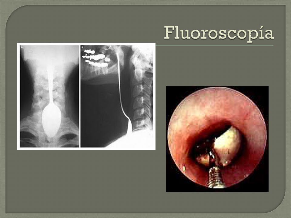 Fluoroscopía