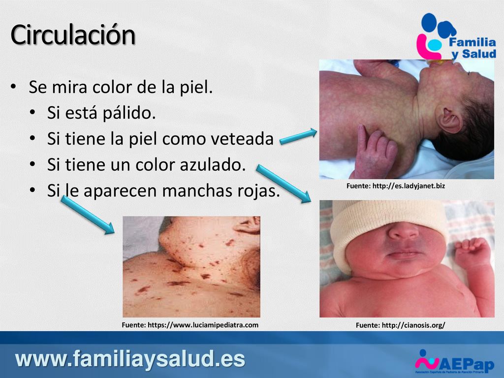 Circulación   Se mira color de la piel.