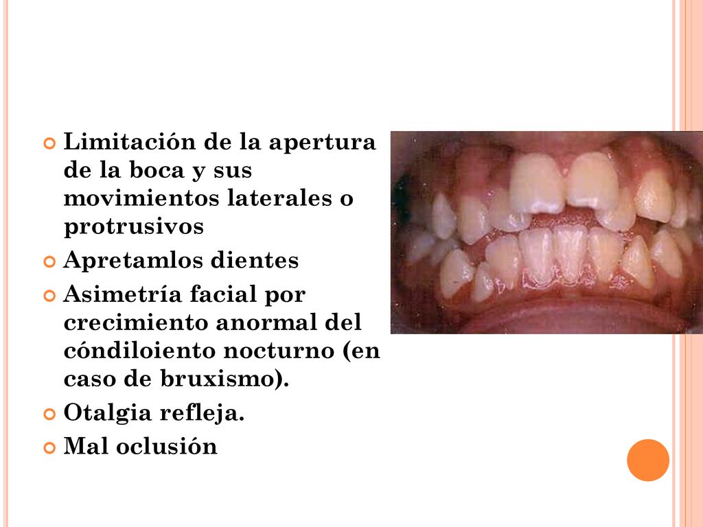 Limitación de la apertura de la boca y sus movimientos laterales o protrusivos