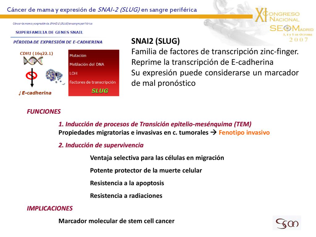 Su expresión puede considerarse un marcador de mal pronóstico