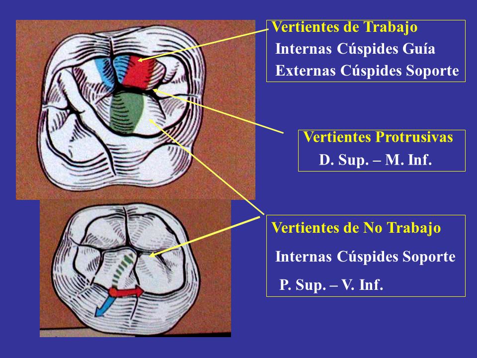 Vertientes de Trabajo Internas Cúspides Guía. Externas Cúspides Soporte. Vertientes Protrusivas. D. Sup. – M. Inf.