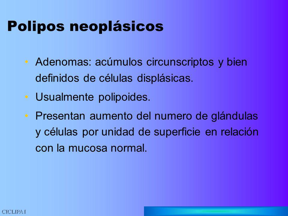 Polipos neoplásicos Adenomas: acúmulos circunscriptos y bien definidos de células displásicas. Usualmente polipoides.
